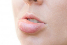 Jarang Diketahui, Ini Faktor Penyebab Bibir Bengkak Serta Cara Mengatasinya 
