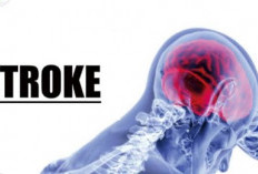 Anda Mau Terhindar Dari Penyakit Stroke, Berbahaya Dan Mematikan ! Ikuti 7 Cara Berikut