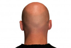 Rasa kurang percaya diri, kekhawatiran, Melihat Lebih Dekat Arti Mimpi Rambut Botak