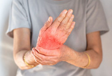 Asam Urat Tak Lagi Menyiksa! Trik Mudah Atasi Nyeri dalam 1 Minggu