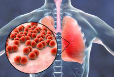 Musim Hujan Sedang Berlangsung ! Waspada, Kenali Resiko Pneumonia Meningkat;