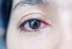 Ketahui Sebelum Menyesal! Inilah 6 Faktor yang Menyebabkan Mata Berair Serta Cara Mengatasinya