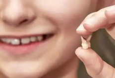 Perspektif Islam dan 5 Makna Mimpi Gigi Copot, Innalillahi Wainnailaihi Rojiun 