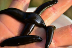 Bakal Sial? Mimpi Digigit Lintah yang Perlu Anda Tahu, Islam Mengkategorikan Mimpi Pada Waktu