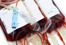 Bikin Takut! Ternyata Ini Arti dari Bermimpi Tentang Darah 