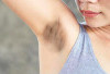 6 Kebiasaan Ini Ternyata yang Menyebabkan Ketiak Hitam, Yuk Hindari!